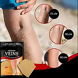 Пластир проти варикозного розширення вен (12 шт.) Veins Patch Бежеві SV227, фото 4