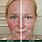 Денний крем проти почервонінь 5 в 1 Sorted Skin 5 in 1 Anti-Redness Day Cream 30 ml, фото 4