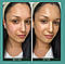 Денний крем проти почервонінь 5 в 1 Sorted Skin 5 in 1 Anti-Redness Day Cream 30 ml, фото 7