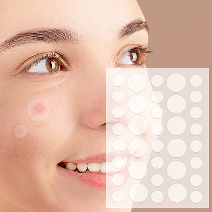 Пластир від прищів та акне 72шт Acne Patch, фото 3