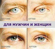 Ліфтинг-смужки для повік CONTOURS RX, 3 мм, 1 пластина, 10 процедур