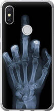 Чохол на Xiaomi Redmi S2 Рука через рентген "1007u-1494-851"