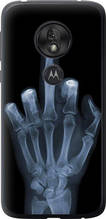 Чохол на Motorola Moto G7 Play Рука через рентген "1007u-1656-851"