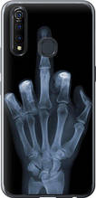 Чохол на Vivo Z5X Рука через рентген "1007u-1765-851"