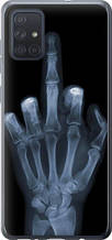 Чохол на Samsung Galaxy A71 2020 A715F Рука через рентген "1007u-1826-851"