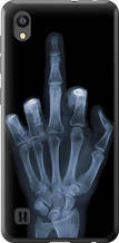 Чохол на ZTE Blade A5 2019 Рука через рентген "1007u-2109-851"