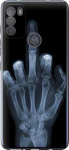 Чохол на Motorola G50 Рука через рентген "1007u-2354-851"