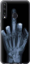 Чохол на Huawei Y6p Рука через рентген "1007u-1952-851"