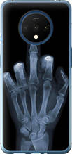 Чохол на OnePlus 7T Рука через рентген "1007u-1809-851"