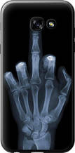 Чохол на Samsung Galaxy A5 (2017) Рука через рентген "1007u-444-851"