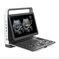 Портативна система ультразвукова діагностична Zoncare M30