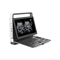 Портативна система ультразвукова діагностична Zoncare M5