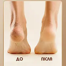 Електрична роликова пилка EasyFit пемза для п'ят із всмоктуванням пилу, Електрична пемза-пилка для ніг, фото 4