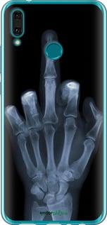 Чохол на Huawei Y9 2019 Рука через рентген "1007u-1602-72104", фото 1