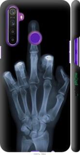 Чохол на Realme 5 Рука через рентген "1007m-1862-7290"