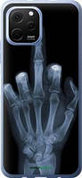 Чохол на Huawei Nova Y61 Рука через рентген "1007u-2983-72104"