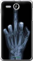 Чохол на Lenovo A529 Рука через рентген "1007u-200-72104"