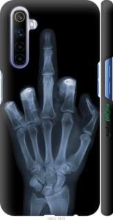 Чохол на Realme 6 Рука через рентген "1007m-1913-7290"