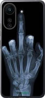 Чохол на Xiaomi Poco C65 Рука через рентген "1007u-3447-72104"