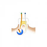 Гутаперчеві штифти SANI конус 02 №45-80 асорті, фото 4