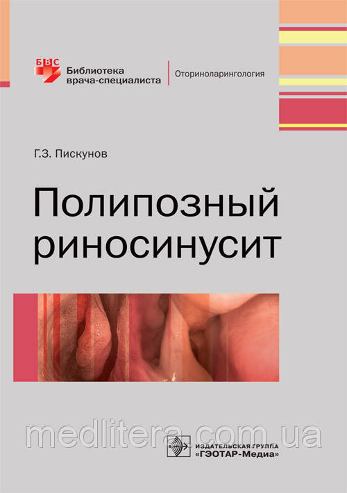 Піскунов Р. З. Поліпозний риносинусит, фото 1