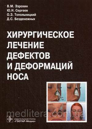 Эзрохин В. М., Сергєєв Ю. Н., Топольницький О. З. Хірургічне лікування дефектів і деформацій носа