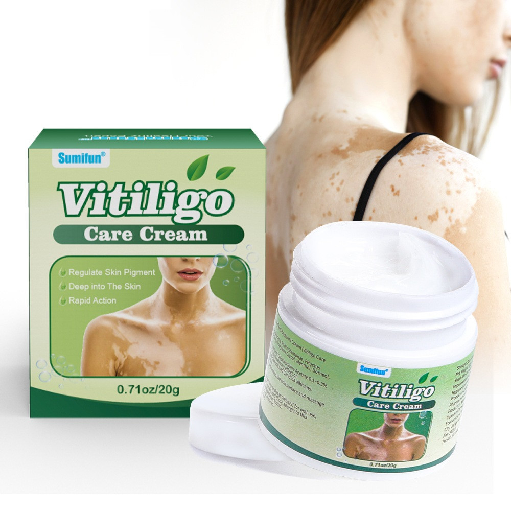 Антибактеріальний крем від Вітиліго (Care cream Vitiligo) 20 г Китай,, фото 1