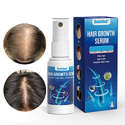 Сироватка для росту волосся у спрею 30 мл. Месний спрей для лікування алопеції й облисіння