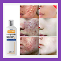 Ефективний спрей проти захворювань шкіри FAFASKIN Cleansing Lotion 150ml