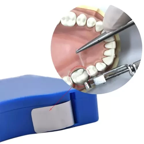 Матриця для сиситеми 3м Тоффльмайра TOP Tofflemire 0.04mm, фото 1