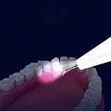 Ультразвуковий скалер з 2 насадками для видалення зубного каменю та догляду за ротовою порожниною акумуляторний, фото 5