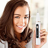 Ультразвуковий скалер з 2 насадками для видалення зубного каменю та догляду за ротовою порожниною акумуляторний, фото 9