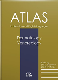 Дерматологія. Венерологія. Dermatology. Venereology: атлас укр. та англ. мовами. Святенко Т.В., Свистунов І.В. (тверда палітурка)