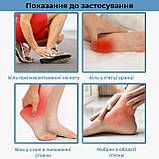 Гомілковостопний бандаж при п'ятковій шпорі Страсбурзький носок, розмір L, фото 3