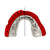 Капа OPRO Gold Braces під брекети доросла (вік 11+) Red/Pearl (art.102506003), фото 7