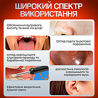 Пристрій для видалення вушної сірки з камерою, очищувач вух з отоскопом Brillix 1296P Чорний (PO-Black), фото 5