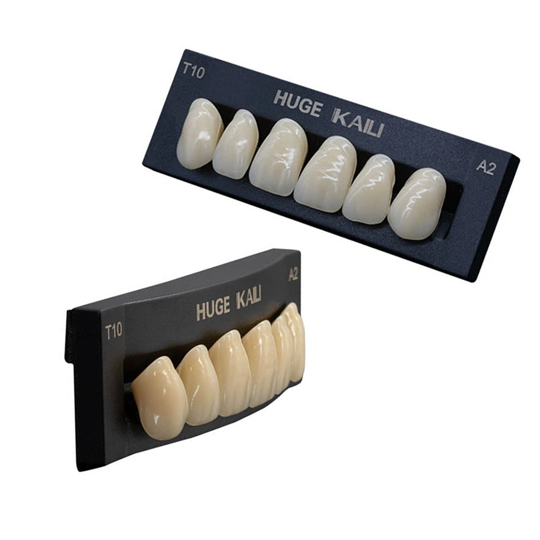 Преимущества вариантов из нашего каталога NewDental