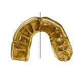 Капа OPRO Gold доросла (вік 11+)  Grillz Black/Gold (art.102504012), фото 4