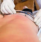 Блейд із медичної сталі з кейсом 5шт, інструмент для ІММТ, фото 5