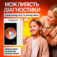 Пристрій для видалення вушної сірки з камерою, очищувач вух з отоскопом Brillix 1296P Чорний (PO-Black), фото 4