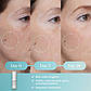 Сироватка проти пігментних плям Elemis Dynamic Resurfacing Super-C Serum, фото 4