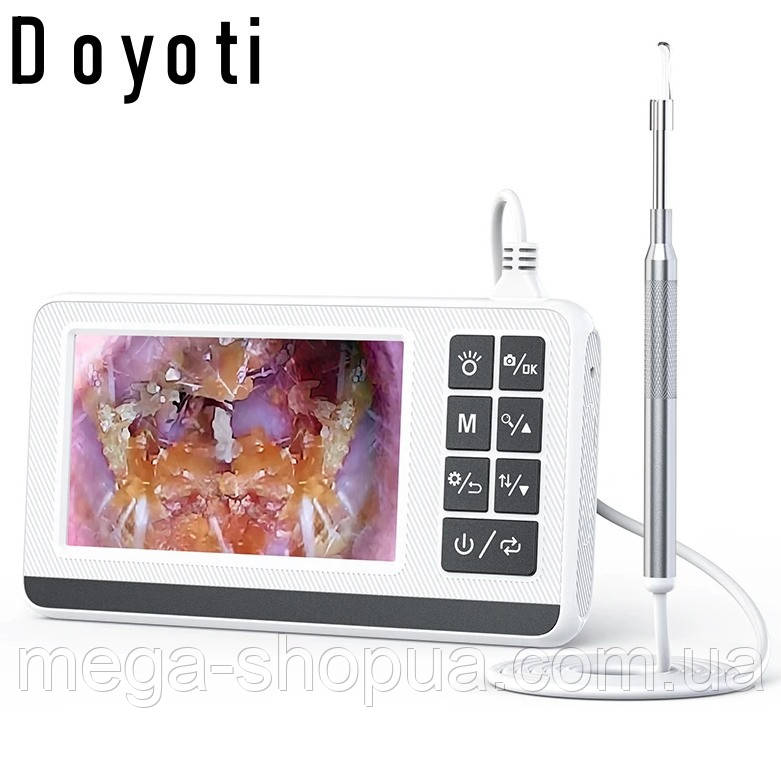 Отоскоп бороскоп з екраном 4.3" 1080p HD 32GB - Багатофункціональний ендоскоп з дисплеєм для вух, зубів DFD88, фото 1
