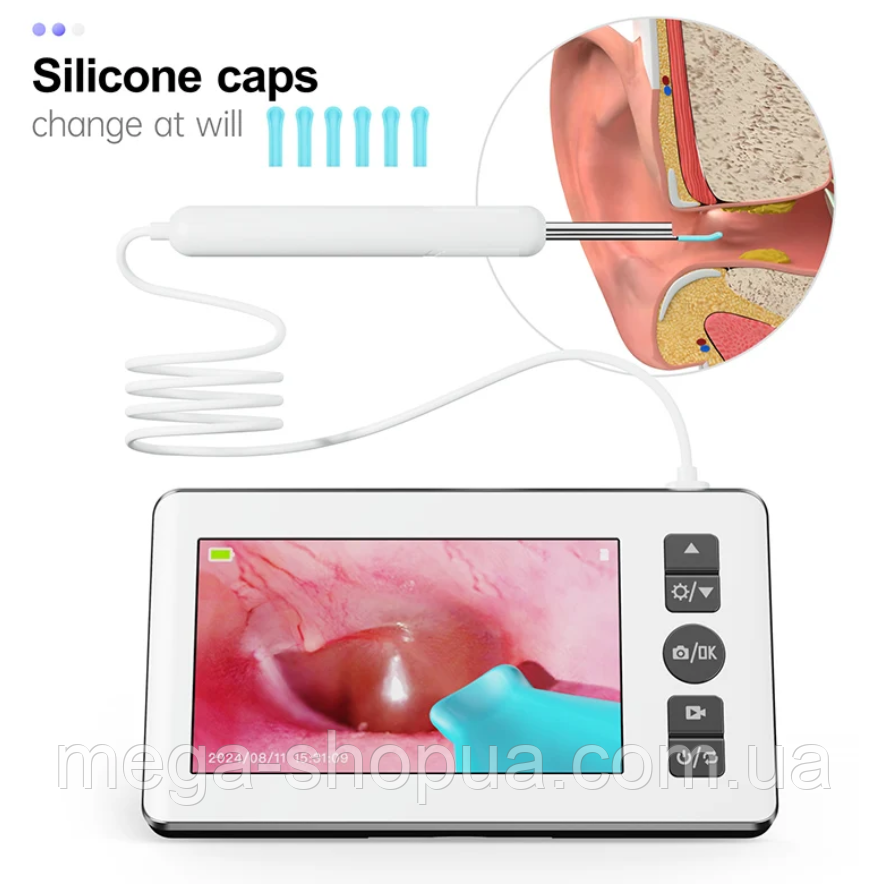 Отоскоп бороскоп з екраном 4.3" 3.5 мм HD 1080p 32GB — Ендоскоп для вух, зубів та діагностики з дисплеєм CS5, фото 1