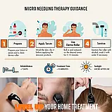 Мезоролер професійний для шкіри Skin Roller 0.3 мм, Дермаролери 540 голок, фото 7