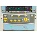 Дефібрилятор-монітор CARDIO-AID 360B з SpO2, водієм ритму та термопринтером | INNOMED, Угорщина, фото 5