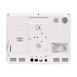 Монітор пацієнта Bistos BT-770 | 12.1", SpO₂, ЕКГ, NIBP, Т°C, CO₂ (опція) | Автономність 5 годин, фото 4