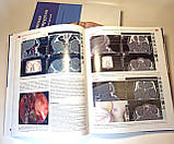 Волмард Ендоскопічна риносинусохірургія. Анатомія, об'ємна реконструкція та хірургічна техніка 2021 р, фото 2