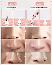 Вакуумний прилад для видалення чорних цяток Blackhead Remover With LED Screen XPRE111 3 рівні всмоктування, фото 4