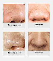 Очищуюча маска для обличчя Lanbena Nose Plants Pore 30 г для видалення чорних точок та вугрів 29249, фото 6