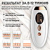 Фотоепілятор жіночий IPL епілятор лазерний портативний компактний 5 рівнів інтенсивності епіляції, фото 3